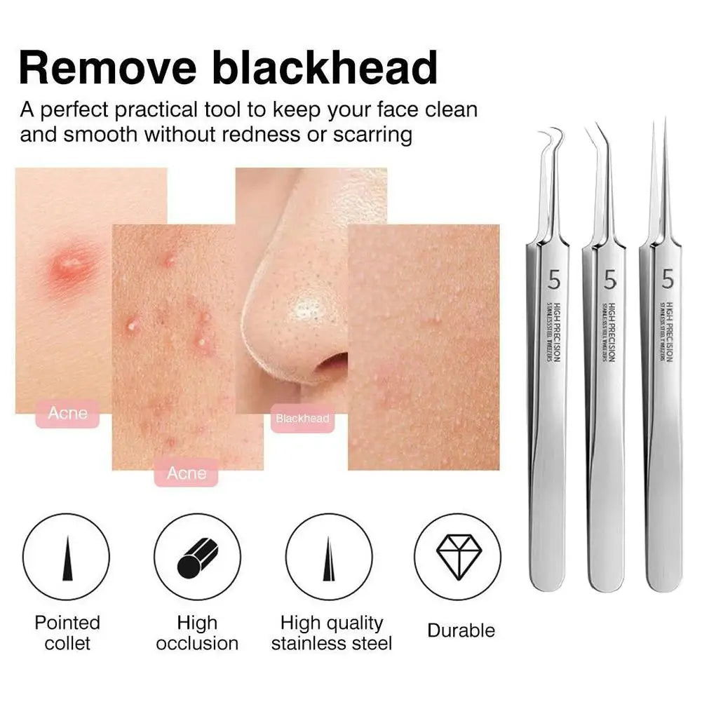 German Ultra-Fine No.5 Blackhead & Pimple Clip Tweezers – Professional Acne Needle Tool