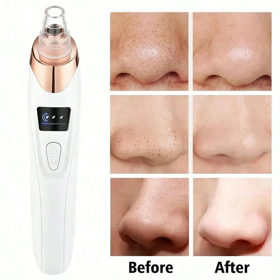 Electric Pore Cleaner & Blackhead Remover – Deep Cleansing Vacuum Device for Face