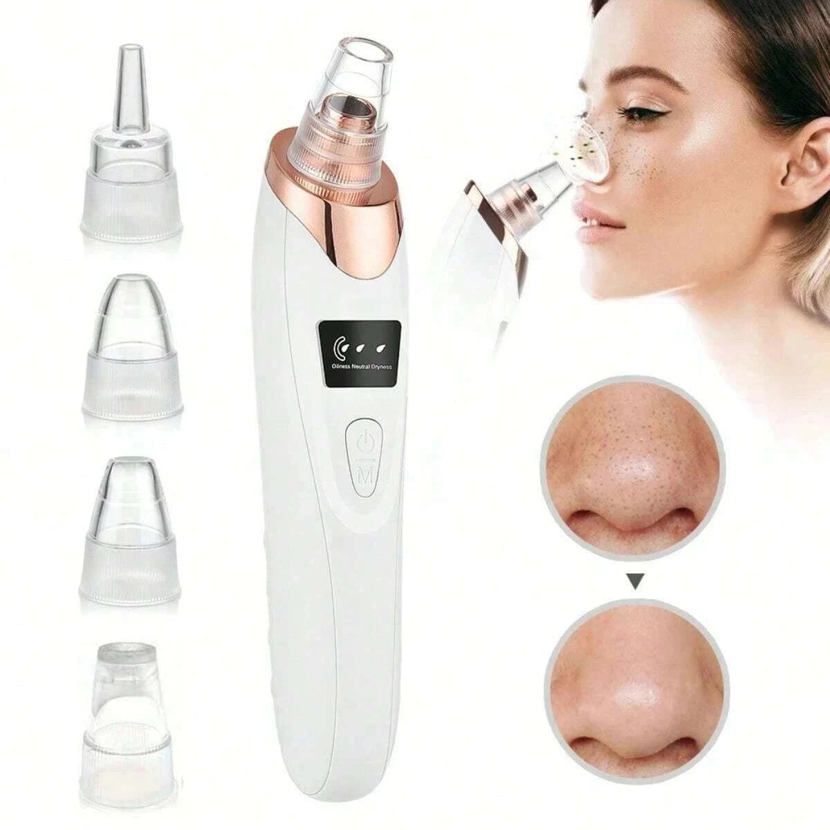 Electric Pore Cleaner & Blackhead Remover – Deep Cleansing Vacuum Device for Face