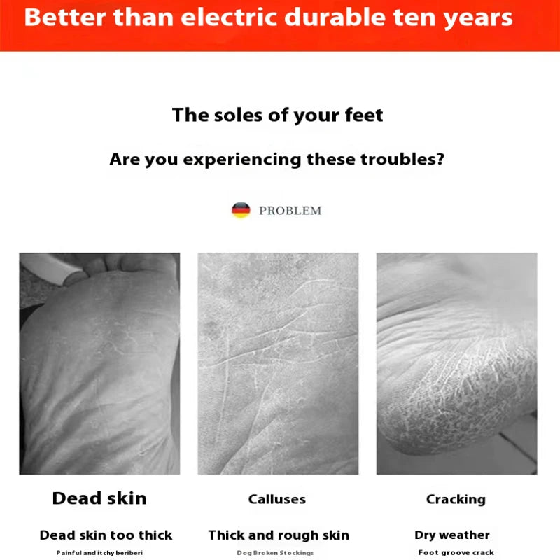 Foot Grinder Callus Remover – Nano Glass Foot Scrubber for Dead Skin & Heel Repair