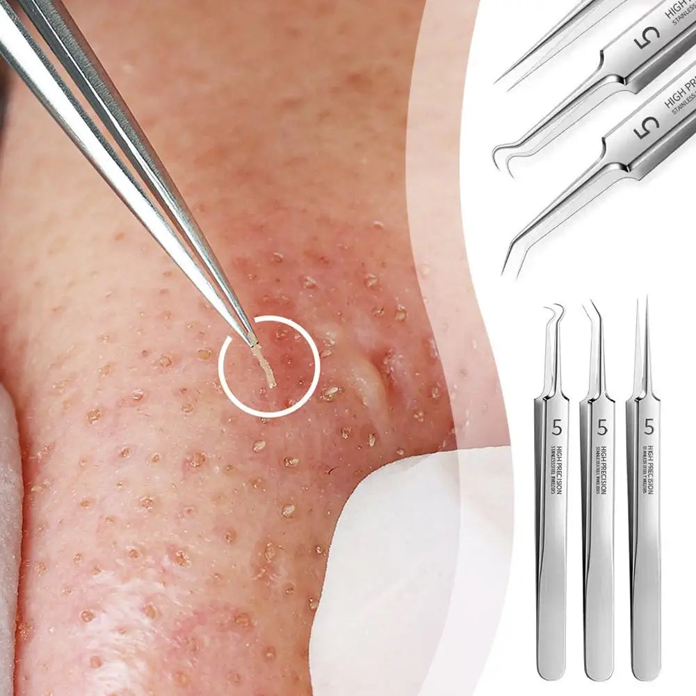 German Ultra-Fine No.5 Blackhead & Pimple Clip Tweezers – Professional Acne Needle Tool