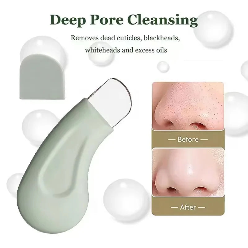Blackhead & Whitehead Removal Tool for Nose & Face – Pore Cleaner Skin Care Tool for Women